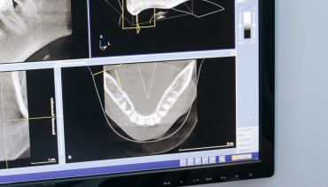 Zubný röntgen